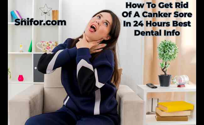 How To Get Rid Of A Canker Sore In 24 Hours: Best Dental Info - Mouth Ulcer Ways To Get Rid Of Canker Sores